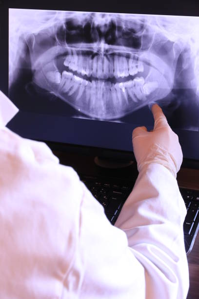 Best Emergency Denture Repair in Kentfield, CA
