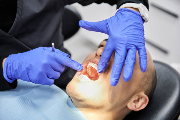 Best Emergency Dental Care for Broken or Chipped Teeth in Kentfield, CA